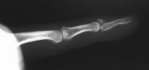 General Orthopedics Board Review 2026: High-Yield MCQs (Set 6) - Figure 52