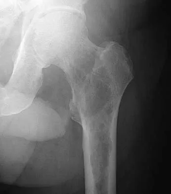 General Orthopedics Board Review 2026: High-Yield MCQs (Set 6) - Figure 61