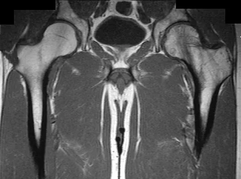 General Orthopedics Board Review 2026: High-Yield MCQs (Set 6) - Figure 66