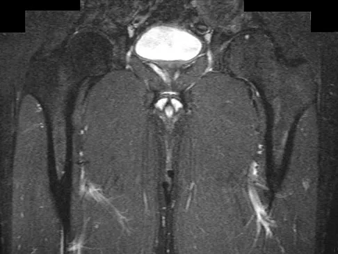 General Orthopedics Board Review 2026: High-Yield MCQs (Set 6) - Figure 67