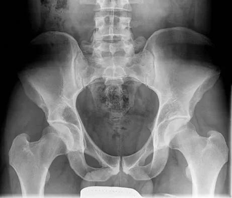 General Orthopedics Board Review 2026: High-Yield MCQs (Set 6) - Figure 70