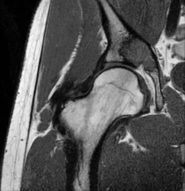 General Orthopedics Board Review 2026: High-Yield MCQs (Set 6) - Figure 72
