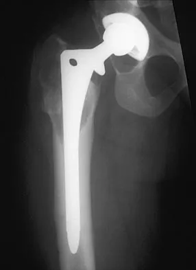 General Orthopedics Board Review 2026: High-Yield MCQs (Set 6) - Figure 75