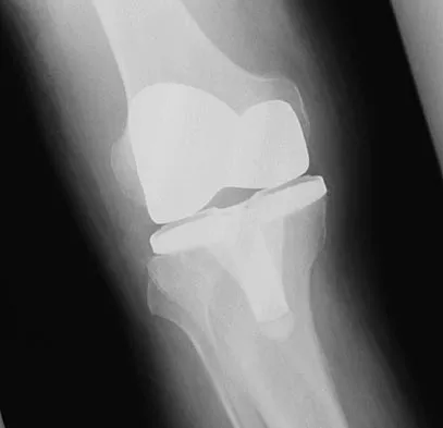 General Orthopedics Board Review 2026: High-Yield MCQs (Set 6) - Figure 78