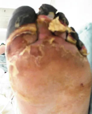 General Orthopedics Board Review 2026: High-Yield MCQs (Set 6) - Figure 96