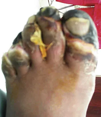 General Orthopedics Board Review 2026: High-Yield MCQs (Set 6) - Figure 97