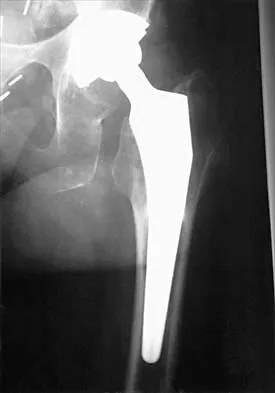 General Orthopedics 2026 Practice Questions: Set 7 (Solved) - Figure 1