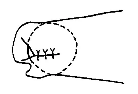 General Orthopedics 2026 Practice Questions: Set 7 (Solved) - Figure 10