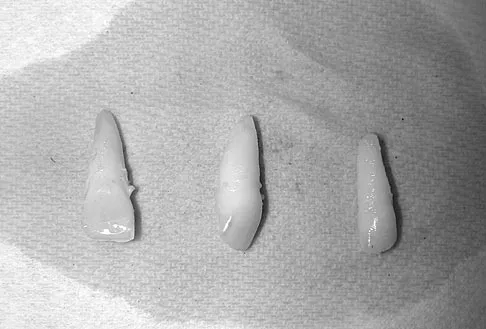 General Orthopedics 2026 Practice Questions: Set 7 (Solved) - Figure 110