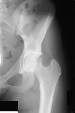 General Orthopedics 2026 Practice Questions: Set 7 (Solved) - Figure 112