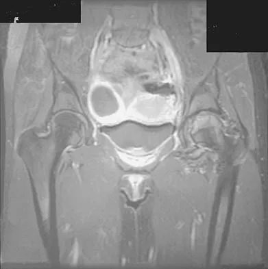 General Orthopedics 2026 Practice Questions: Set 7 (Solved) - Figure 114
