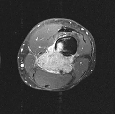 General Orthopedics 2026 Practice Questions: Set 7 (Solved) - Figure 13