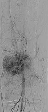 General Orthopedics 2026 Practice Questions: Set 7 (Solved) - Figure 14