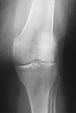General Orthopedics 2026 Practice Questions: Set 7 (Solved) - Figure 20