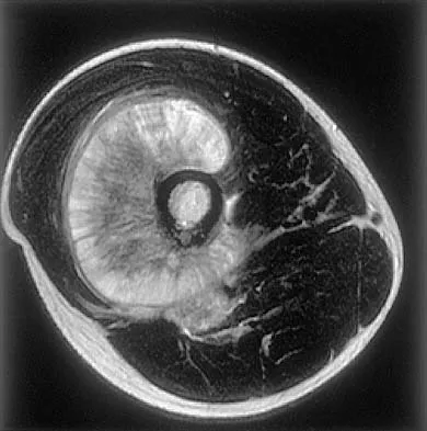 General Orthopedics 2026 Practice Questions: Set 7 (Solved) - Figure 23