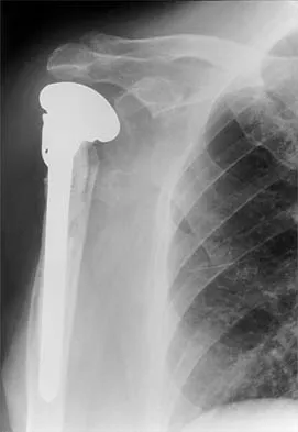 General Orthopedics 2026 Practice Questions: Set 7 (Solved) - Figure 25