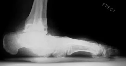 General Orthopedics 2026 Practice Questions: Set 7 (Solved) - Figure 29