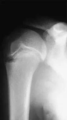 General Orthopedics 2026 Practice Questions: Set 7 (Solved) - Figure 30