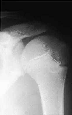 General Orthopedics 2026 Practice Questions: Set 7 (Solved) - Figure 31