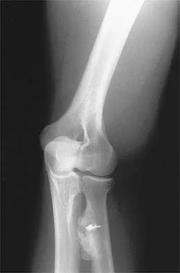 General Orthopedics 2026 Practice Questions: Set 7 (Solved) - Figure 33