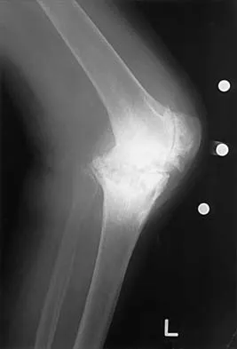 General Orthopedics 2026 Practice Questions: Set 7 (Solved) - Figure 4