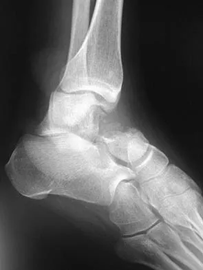 General Orthopedics 2026 Practice Questions: Set 7 (Solved) - Figure 41