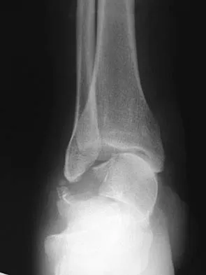 General Orthopedics 2026 Practice Questions: Set 7 (Solved) - Figure 42