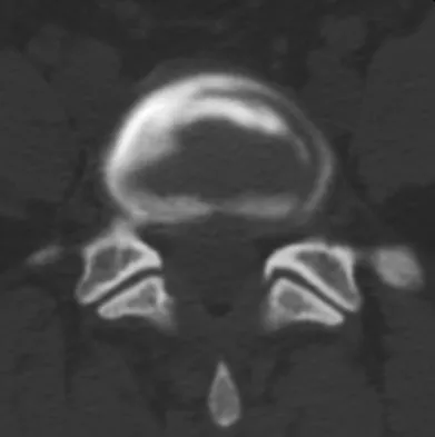 General Orthopedics 2026 Practice Questions: Set 7 (Solved) - Figure 48