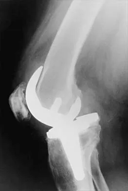 General Orthopedics 2026 Practice Questions: Set 7 (Solved) - Figure 56