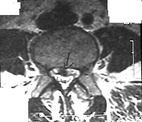 General Orthopedics 2026 Practice Questions: Set 7 (Solved) - Figure 75