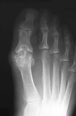 General Orthopedics 2026 Practice Questions: Set 7 (Solved) - Figure 85