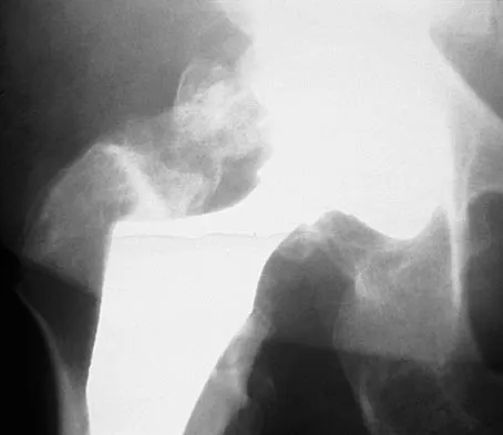 General Orthopedics 2026 Practice Questions: Set 7 (Solved) - Figure 90