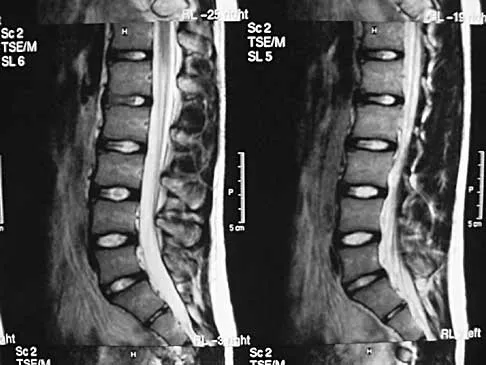 General Orthopedics 2026 Practice Questions: Set 7 (Solved) - Figure 92