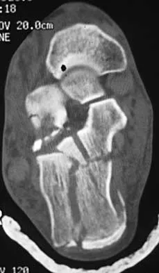 General Orthopedics Board Review 2026: High-Yield MCQs (Set 8) - Figure 11