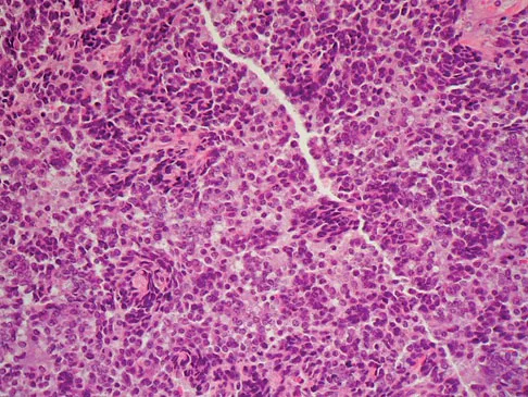 General Orthopedics Board Review 2026: High-Yield MCQs (Set 8) - Figure 18