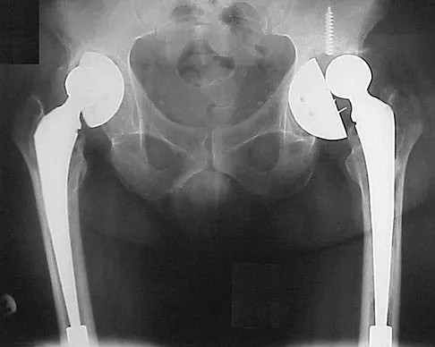 General Orthopedics Board Review 2026: High-Yield MCQs (Set 8) - Figure 20