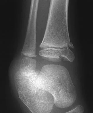 General Orthopedics Board Review 2026: High-Yield MCQs (Set 8) - Figure 28