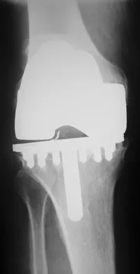 General Orthopedics Board Review 2026: High-Yield MCQs (Set 8) - Figure 39