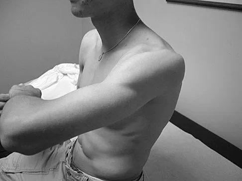 General Orthopedics Board Review 2026: High-Yield MCQs (Set 8) - Figure 40