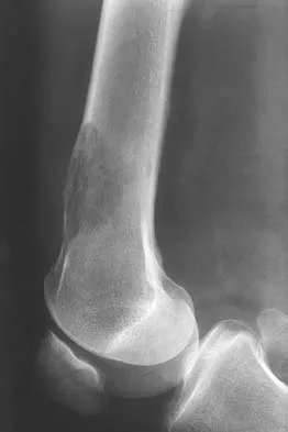 General Orthopedics Board Review 2026: High-Yield MCQs (Set 8) - Figure 47