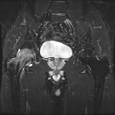 General Orthopedics Board Review 2026: High-Yield MCQs (Set 8) - Figure 53