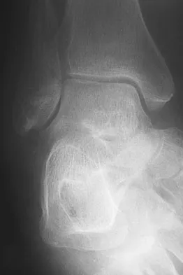 General Orthopedics Board Review 2026: High-Yield MCQs (Set 8) - Figure 59