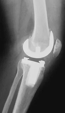 General Orthopedics Board Review 2026: High-Yield MCQs (Set 8) - Figure 6