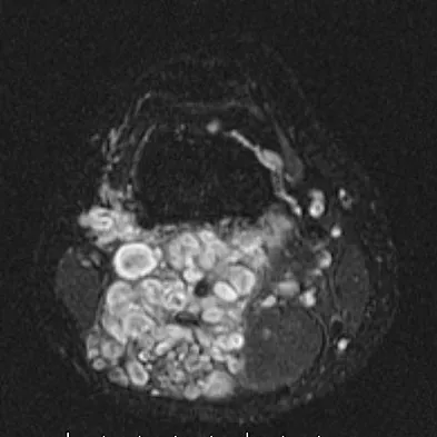 General Orthopedics Board Review 2026: High-Yield MCQs (Set 8) - Figure 67
