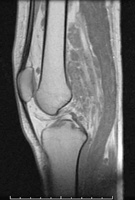 General Orthopedics Board Review 2026: High-Yield MCQs (Set 8) - Figure 69