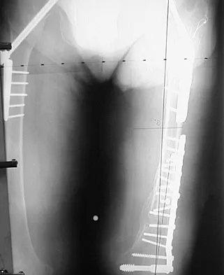 General Orthopedics Board Review 2026: High-Yield MCQs (Set 8) - Figure 72