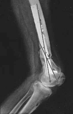 General Orthopedics Board Review 2026: High-Yield MCQs (Set 8) - Figure 73