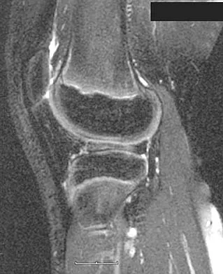 General Orthopedics Board Review 2026: High-Yield MCQs (Set 8) - Figure 74