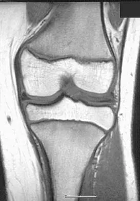 General Orthopedics Board Review 2026: High-Yield MCQs (Set 8) - Figure 75