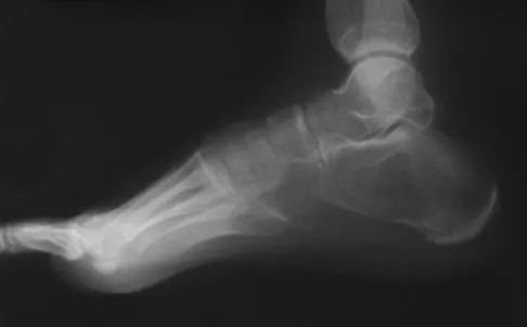 General Orthopedics Board Review 2026: High-Yield MCQs (Set 8) - Figure 79